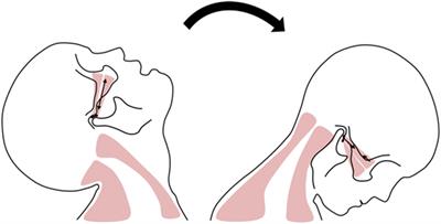 Magnetic Resonance Imaging-Based Prediction of the Relationship between Whiplash Injury and Temporomandibular Disorders